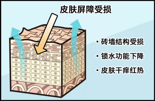 皮膚屏障受損后應(yīng)該如何修護？